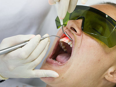 MK Dental Group | Crowns  amp  Caps, Teeth Whitening and VELscope reg  Cancer Screening